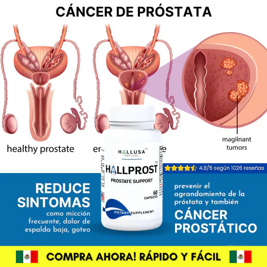 HALLPROST Tratamiento Completo-ENVIO GRATIS