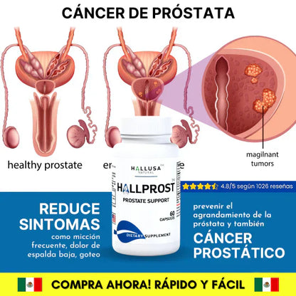 HALLPROST Tratamiento Completo-ENVIO GRATIS